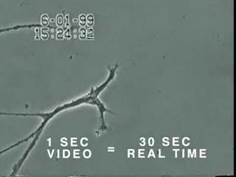 Brain Neuron Degeneration